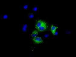 MTRF1L Mouse anti-Human, Clone: OTI2C6, lyophilized, TrueMAB 100 &mu;g;
