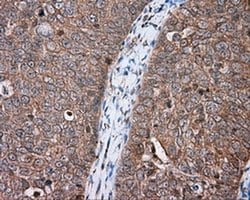 MTRF1L Monoclonal Antibody (OTI2H8), TrueMAB , OriGene:Antibodies:Primary