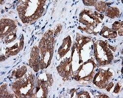 MTRF1L Monoclonal Antibody (OTI1C5), TrueMAB , OriGene 100 &mu;L; Unconjugated:Antibodies,