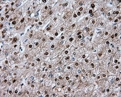 MTRF1L Monoclonal Antibody (OTI1C5), TrueMAB , OriGene 100 &mu;L; Unconjugated:Antibodies,
