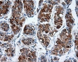 MTRF1L Monoclonal Antibody (OTI1C5), TrueMAB , OriGene 100 &mu;L; Unconjugated:Antibodies,