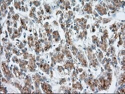 MTRF1L Mouse anti-Human, Clone: OTI2C6, lyophilized, TrueMAB 100 &mu;g;