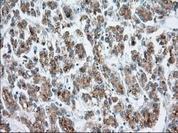 MTRF1L Monoclonal Antibody (OTI2C6), TrueMAB , OriGene 30 &mu;L; Unconjugated:Antibodies,