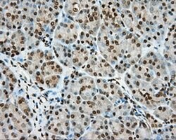 MTRF1L Mouse anti-Human, Clone: OTI2B5, liquid, TrueMAB 100 &mu;L; Unconjugated:Antibodies,