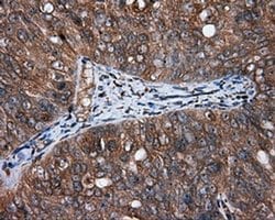 MTRF1L Monoclonal Antibody (OTI1H5), TrueMAB , OriGene:Antibodies:Primary