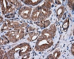 MTRF1L Monoclonal Antibody (OTI1H5), TrueMAB , OriGene 100 &mu;L; Unconjugated:Antibodies,