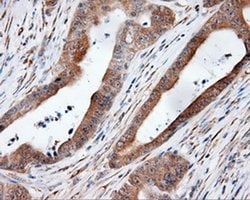 MTRF1L Monoclonal Antibody (OTI1H5), TrueMAB , OriGene 100 &mu;L; Unconjugated:Antibodies,