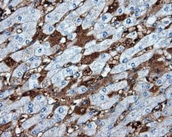 MTRF1L Monoclonal Antibody (OTI1H5), TrueMAB , OriGene:Antibodies:Primary