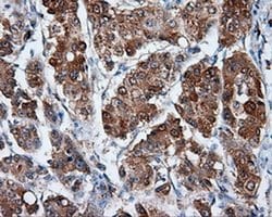 MTRF1L Monoclonal Antibody (OTI1H5), TrueMAB , OriGene 100 &mu;L; Unconjugated:Antibodies,