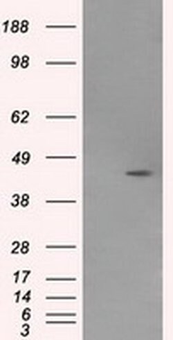 MTRF1L Monoclonal Antibody (OTI1D11), TrueMAB , OriGene 100 &mu;L; Unconjugated:Antibodies,