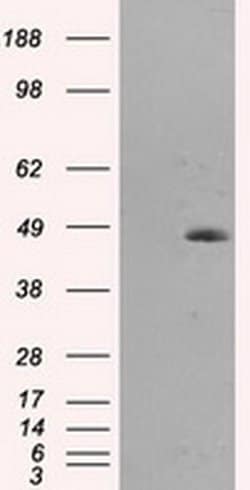 MTRF1L Monoclonal Antibody (OTI1H5), TrueMAB , OriGene 100 &mu;L; Unconjugated:Antibodies,