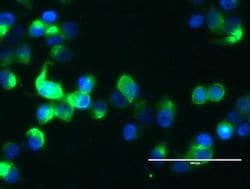 MUC1 Monoclonal Antibody (OTI4A5), TrueMAB , OriGene 100 &mu;L; Unconjugated:Antibodies,