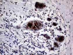 MUC1 Monoclonal Antibody (OTI4A5), TrueMAB , OriGene 100 &mu;L; Unconjugated:Antibodies,