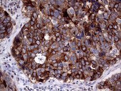MUC1 Monoclonal Antibody (OTI4A5), TrueMAB , OriGene 100 &mu;L; Unconjugated:Antibodies,