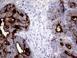 MUC1 Monoclonal Antibody (OTI4A5), TrueMAB , OriGene:Antibodies:Primary