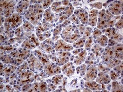 MUC1 Monoclonal Antibody (OTI4A5), TrueMAB , OriGene 100 &mu;L; Unconjugated:Antibodies,