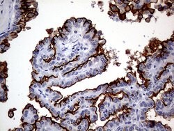 MUC1 Monoclonal Antibody (OTI4A5), TrueMAB , OriGene 100 &mu;L; Unconjugated:Antibodies,