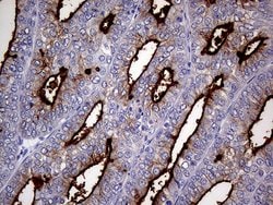 MUC1 Monoclonal Antibody (OTI4A5), TrueMAB , OriGene 100 &mu;L; Unconjugated:Antibodies,