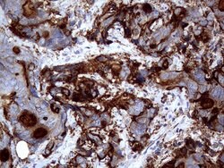 MUC1 Monoclonal Antibody (OTI4A5), TrueMAB , OriGene 100 &mu;L; Unconjugated:Antibodies,