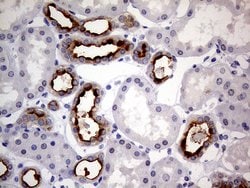 MUC1 Monoclonal Antibody (OTI4A5), TrueMAB , OriGene 100 &mu;L; Unconjugated:Antibodies,