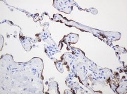 MUC1 Monoclonal Antibody (OTI4A5), TrueMAB , OriGene:Antibodies:Primary