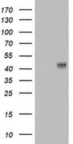 MUC1 Monoclonal Antibody (OTIA3E2), TrueMAB , OriGene:Antibodies:Primary