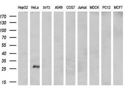 MUC1 Mouse anti-Human, Clone: OTI2F6, lyophilized, TrueMAB 100 &mu;g; Unconjugated:Antibodies,