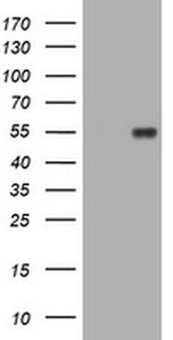 MUC1 Monoclonal Antibody (OTI2E3), TrueMAB , OriGene 30 &mu;L; Unconjugated:Antibodies,