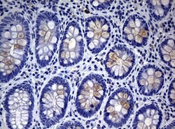 MUC16 Mouse anti-Human, Clone: OTI3B6, lyophilized, TrueMAB 100 &mu;g;