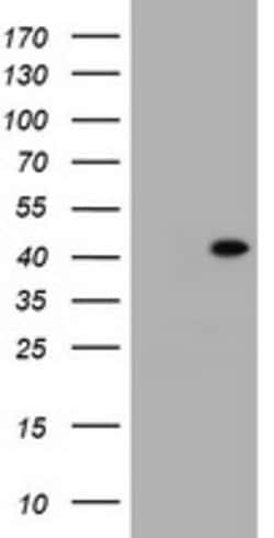 MUC16 Mouse anti-Human, Clone: OTI2C4, lyophilized, TrueMAB 100 &mu;g;