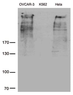 MUC16 Monoclonal Antibody (OTI3C6), TrueMAB , OriGene 100 &mu;L; Unconjugated:Antibodies,