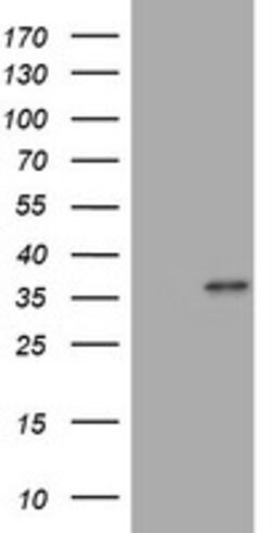 MUC16 Mouse anti-Human, Clone: OTI2F1C9, lyophilized, TrueMAB 100 &mu;g;