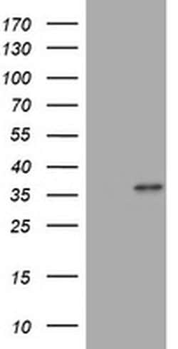 MUC16 Monoclonal Antibody (OTI2F1C9), TrueMAB , OriGene:Antibodies:Primary
