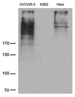 MUC16 Mouse anti-Human, Clone: OTI2F1C9, lyophilized, TrueMAB 100 &mu;g;