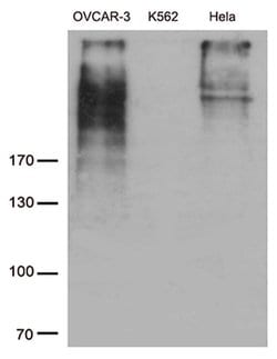 MUC16 Monoclonal Antibody (OTI2F1C9), TrueMAB , OriGene:Antibodies:Primary