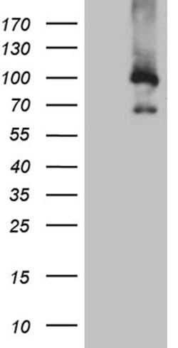 MUM1 Monoclonal Antibody (OTI1B2), TrueMAB , OriGene:Antibodies:Primary