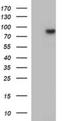 MUT Mouse anti-Human, Clone: OTI2A8, TrueMAB , Origene 30 &mu;L; Unconjugated:Antibodies,