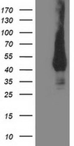 MVK Monoclonal Antibody (OTI 1D7), TrueMAB , OriGene:Antibodies:Primary