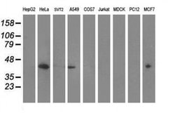 MVK Monoclonal Antibody (OTI 1D7), TrueMAB , OriGene 30 &mu;L; Unconjugated:Antibodies,