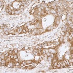 MVP/Major Vault Protein Rabbit anti-Human, Polyclonal, Bethyl Laboratories
