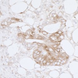 MVP/Major Vault Protein Rabbit anti-Human, Polyclonal, Bethyl Laboratories
