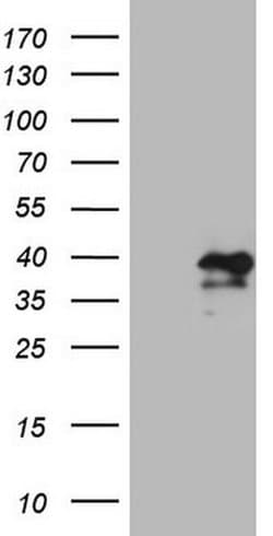 MXD4 Monoclonal Antibody (OTI1A2), TrueMAB , OriGene 100 &mu;L | Buy Online | OriGene | Fisher Scientific