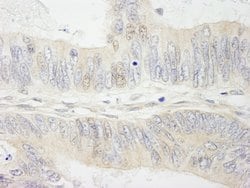 MYBBP1A Polyclonal Antibody, Bethyl Laboratories:Antibodies:Primary Antibodies