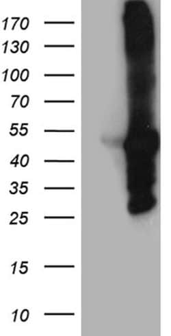 MYBPC2 Mouse anti-Human, Clone: OTI2E1, lyophilized, TrueMAB 100 &mu;g;