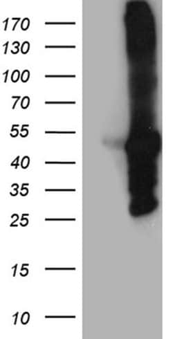 MYBPC2 Monoclonal Antibody (OTI2E1), TrueMAB , OriGene 30 &mu;L; Unconjugated:Antibodies,