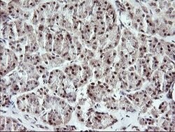 MYBPH Mouse anti-Human, Clone: OTI3G1, liquid, TrueMAB 100 &mu;L | Buy Online | Origene Technologies | Fisher Scientific