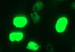 MYC Monoclonal Antibody (OTI5E9G2), TrueMAB , OriGene:Antibodies:Primary