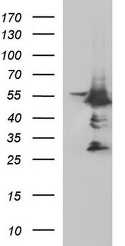 MYC Monoclonal Antibody (OTI5E9G2), TrueMAB , OriGene 100 &mu;L; Unconjugated:Antibodies,