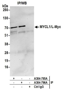 MYCL1/L-Myc Rabbit anti-Human, Polyclonal, Bethyl Laboratories 100 &mu;L;