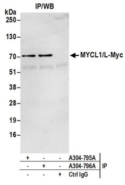 MYCL1/L-Myc Rabbit anti-Human, Polyclonal, Bethyl Laboratories 10 &mu;L;